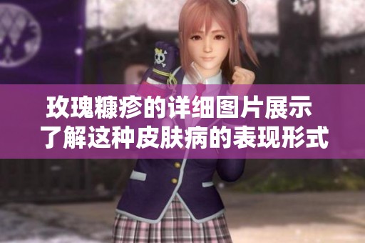 玫瑰糠疹的详细图片展示 了解这种皮肤病的表现形式