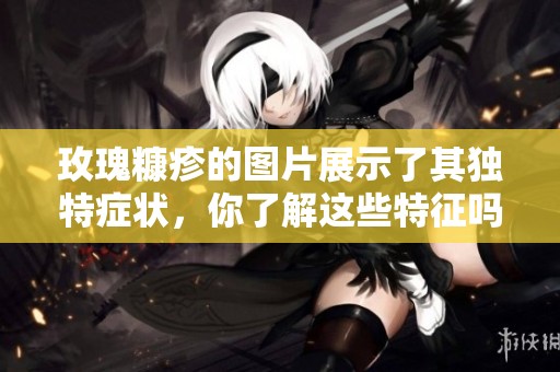 玫瑰糠疹的图片展示了其独特症状，你了解这些特征吗